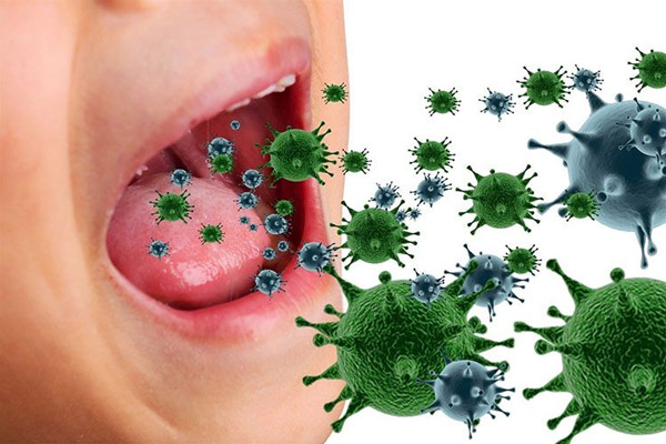 Virus, vi khuẩn là nguyên nhân hàng đầu khiến trẻ bị viêm họng